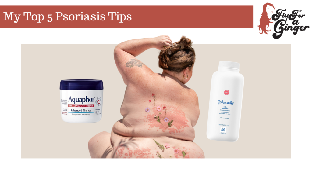 psoriasis tips